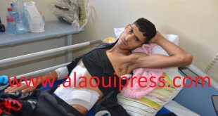 أيوب بوكرعة ضحية الطعنات الحادة بالسلاح الأبيض على مستوى القلب يناشد مسؤولي الأمن بفاس بإعتقال الجناة